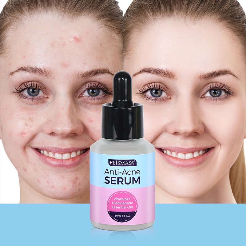 Sérum visage de traitement anti-acné et boutons - 9